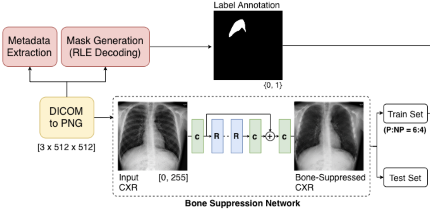 Bone suppression for pneumothorax segmentation teaser
