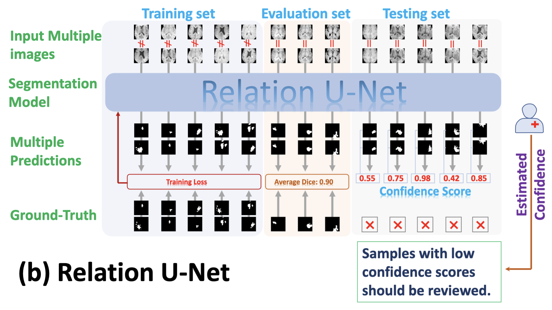 Relation U-Net teaser