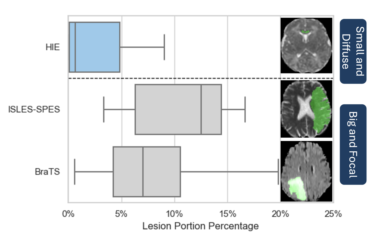 BONBID-HIE lesion segmentation teaser